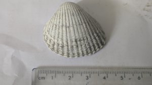 Carditid - Measurement 3-4cm