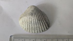 Carditid - Measurement ~3cm