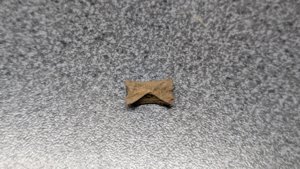 Vertebra - cross-section