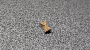 Vertebra - cross-section