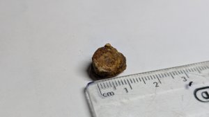 Vertebra - measurement ~1cm
