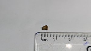 Vertebra - measurement ~0.4cm