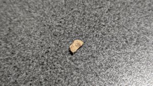 Vertebra, broken in the middle